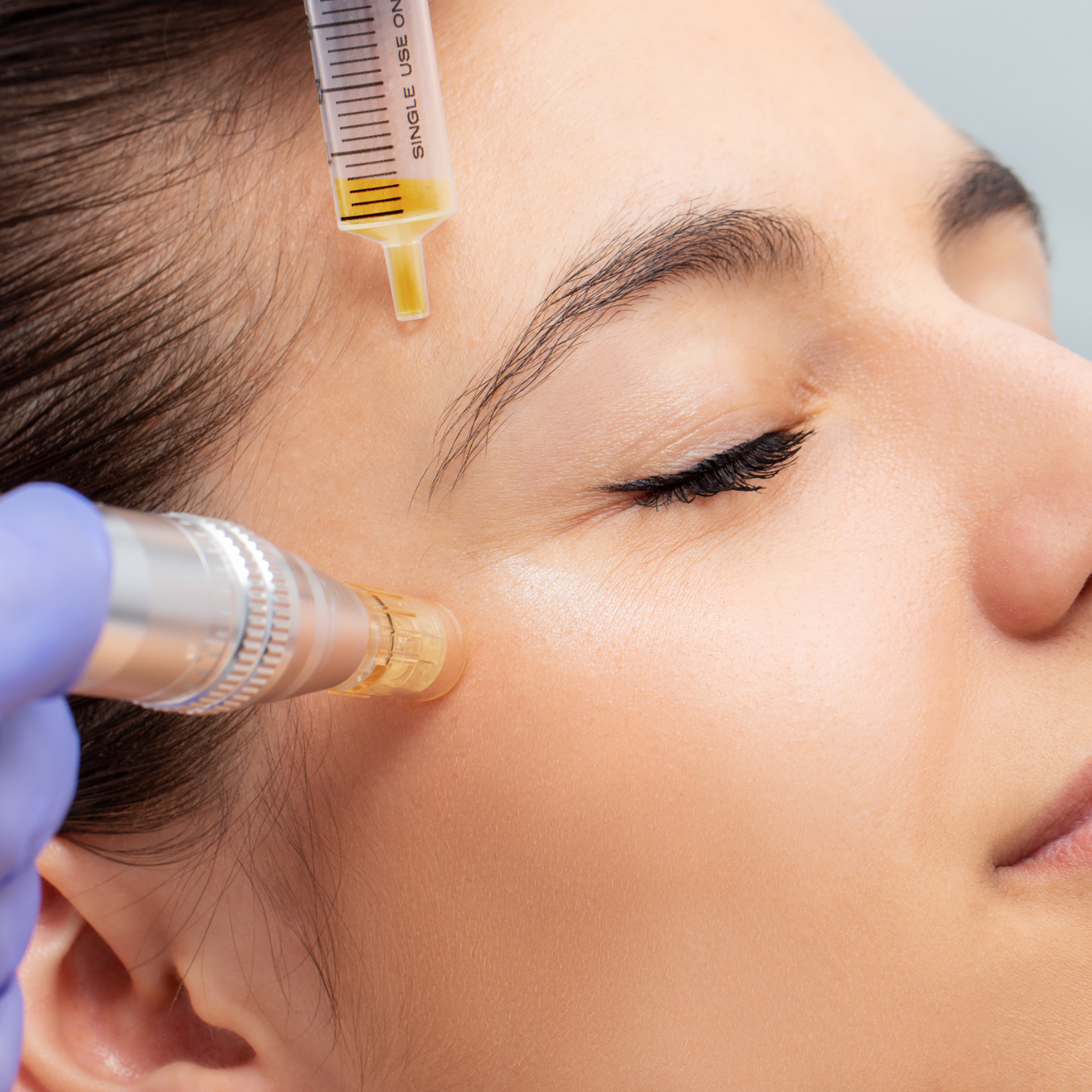 Skin Needling Course